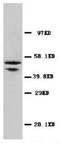 HsMAD2 antibody, AP23361PU-N, Origene, Western Blot image 