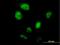 Zinc Finger Protein 738 antibody, H00148203-B01P, Novus Biologicals, Immunofluorescence image 