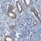 Membrane Spanning 4-Domains A10 antibody, NBP2-31998, Novus Biologicals, Immunohistochemistry paraffin image 