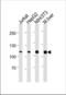 Nuclear Receptor Subfamily 3 Group C Member 1 antibody, TA324708, Origene, Western Blot image 