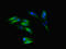 SLIT And NTRK Like Family Member 5 antibody, orb53011, Biorbyt, Immunofluorescence image 
