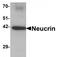 Dorsal Inhibitory Axon Guidance Protein antibody, TA320182, Origene, Western Blot image 