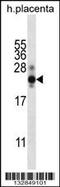 Choriogonadotropin subunit beta antibody, 56-809, ProSci, Western Blot image 