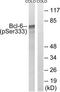 B-cell lymphoma 6 protein antibody, TA311904, Origene, Western Blot image 