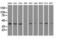 Mitogen-Activated Protein Kinase 1 antibody, GTX84159, GeneTex, Western Blot image 
