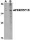 Phospholipid Phosphatase 5 antibody, NBP1-76244, Novus Biologicals, Western Blot image 