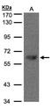 Transducin Beta Like 1 X-Linked antibody, NBP1-31058, Novus Biologicals, Western Blot image 