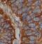 Cell surface glycoprotein MUC18 antibody, FNab01429, FineTest, Immunohistochemistry paraffin image 