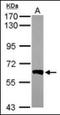 Serine/threonine-protein phosphatase 2B catalytic subunit beta isoform antibody, orb181670, Biorbyt, Western Blot image 