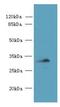 Coiled-coil domain-containing protein 106 antibody, A58450-100, Epigentek, Western Blot image 