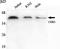 Cyclin Dependent Kinase 5 antibody, STJ98477, St John
