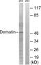 Dematin antibody, GTX87430, GeneTex, Western Blot image 
