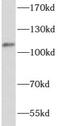 Potassium-transporting ATPase alpha chain 2 antibody, FNab00689, FineTest, Western Blot image 