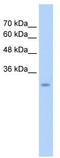 GTP Binding Protein Overexpressed In Skeletal Muscle antibody, TA346399, Origene, Western Blot image 