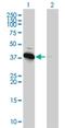 Protein Kinase AMP-Activated Non-Catalytic Subunit Beta 1 antibody, H00005564-M01, Novus Biologicals, Western Blot image 