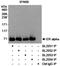 Estrogen Receptor 1 antibody, A300-497A, Bethyl Labs, Immunoprecipitation image 