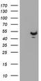 Potassium Voltage-Gated Channel Subfamily A Member Regulatory Beta Subunit 1 antibody, TA503969S, Origene, Western Blot image 