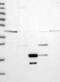 Vacuolar Protein Sorting 36 Homolog antibody, PA5-60561, Invitrogen Antibodies, Western Blot image 