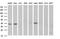 Malonyl-CoA-acyl carrier protein transacylase, mitochondrial antibody, NBP2-45771, Novus Biologicals, Western Blot image 