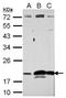 Ribonuclease A Family Member 11 (Inactive) antibody, GTX122951, GeneTex, Western Blot image 