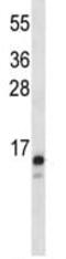 Mitochondrial import inner membrane translocase subunit Tim23 antibody, ab116329, Abcam, Western Blot image 