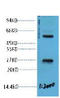 EF-Hand Domain Family Member D1 antibody, STJ97096, St John