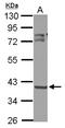 3-Oxoacyl-ACP Synthase, Mitochondrial antibody, LS-C155757, Lifespan Biosciences, Western Blot image 