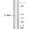 STE20 Related Adaptor Alpha antibody, A01112, Boster Biological Technology, Western Blot image 