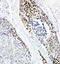 Tumor Protein P63 antibody, LS-C313184, Lifespan Biosciences, Immunohistochemistry paraffin image 