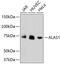 5'-Aminolevulinate Synthase 1 antibody, 13-922, ProSci, Western Blot image 