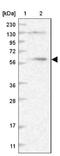 Cytoplasmic dynein 1 intermediate chain 1 antibody, NBP1-87972, Novus Biologicals, Western Blot image 