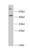 CD63 Molecule antibody, FNab01490, FineTest, Western Blot image 