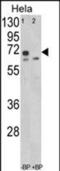 Leiomodin 1 antibody, PA5-49616, Invitrogen Antibodies, Western Blot image 
