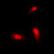 SMAD Family Member 3 antibody, LS-C358329, Lifespan Biosciences, Immunofluorescence image 