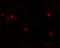 Ubiquitin Specific Peptidase 10 antibody, A03786, Boster Biological Technology, Immunofluorescence image 