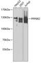 Protein Phosphatase 6 Regulatory Subunit 2 antibody, GTX32856, GeneTex, Western Blot image 