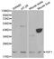Insulin Like Growth Factor 1 antibody, TA332383, Origene, Western Blot image 
