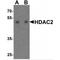 Histone Deacetylase 2 antibody, MBS153411, MyBioSource, Western Blot image 