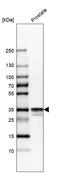 Calponin 1 antibody, HPA014263, Atlas Antibodies, Western Blot image 