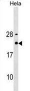 HRF antibody, abx030034, Abbexa, Western Blot image 