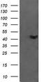 Ciliogenesis Associated TTC17 Interacting Protein antibody, TA505575BM, Origene, Western Blot image 