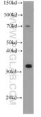 Sulfotransferase 4A1 antibody, 66106-1-Ig, Proteintech Group, Western Blot image 