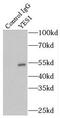 Proto-oncogene tyrosine-protein kinase Yes antibody, FNab09563, FineTest, Immunoprecipitation image 