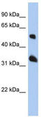 Tetraspanin 33 antibody, TA333425, Origene, Western Blot image 