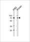 Tumor Protein P73 antibody, PA5-35368, Invitrogen Antibodies, Western Blot image 