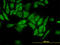 Ribosomal Protein L4 antibody, LS-B11238, Lifespan Biosciences, Immunofluorescence image 