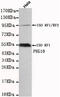 Paternally Expressed 10 antibody, MBS475079, MyBioSource, Western Blot image 