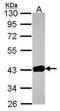 GRB2-related adapter protein 2 antibody, GTX115233, GeneTex, Western Blot image 