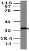 C-Type Lectin Domain Containing 6A antibody, M11863, Boster Biological Technology, Western Blot image 