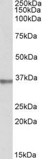 Spondin 2 antibody, STJ72212, St John
